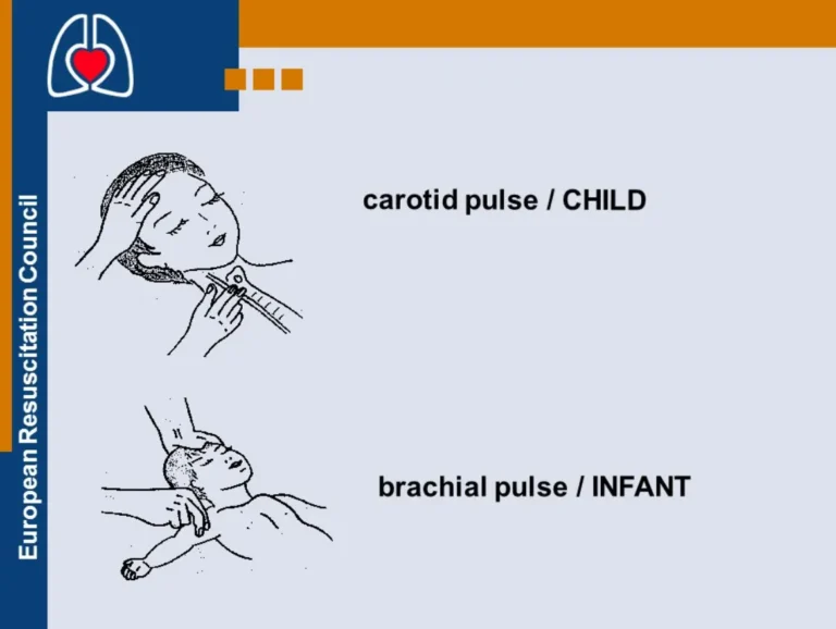 Latest Changes in PALS Post Arrest Shock Management Algorithm